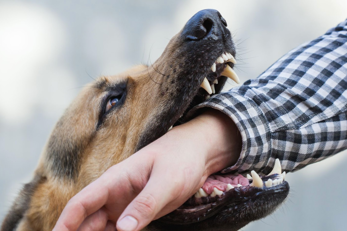 Whittier Dog Bite Attorney Arcadia Animal Attack Lawyer